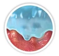 illustration of how Hydrofiber Technology works