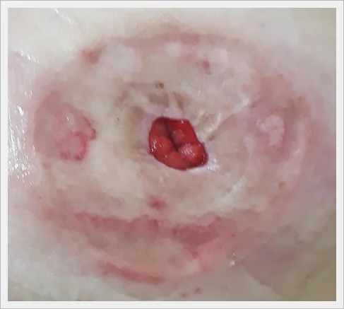 人の口のクローズアップ