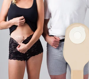 a woman and a man showing their stomas