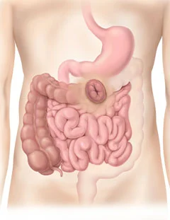 a baby's hand with a heart shape