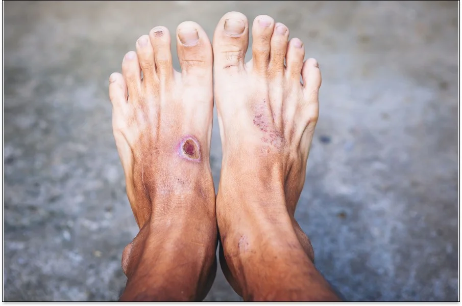 une paire de pieds avec des ongles peints