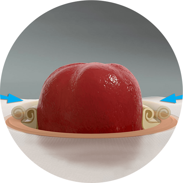 성형 가능한 베이스 플레이트의 클로즈업